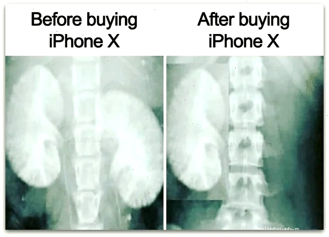 Meme hài hước Meme bán thận hài hước